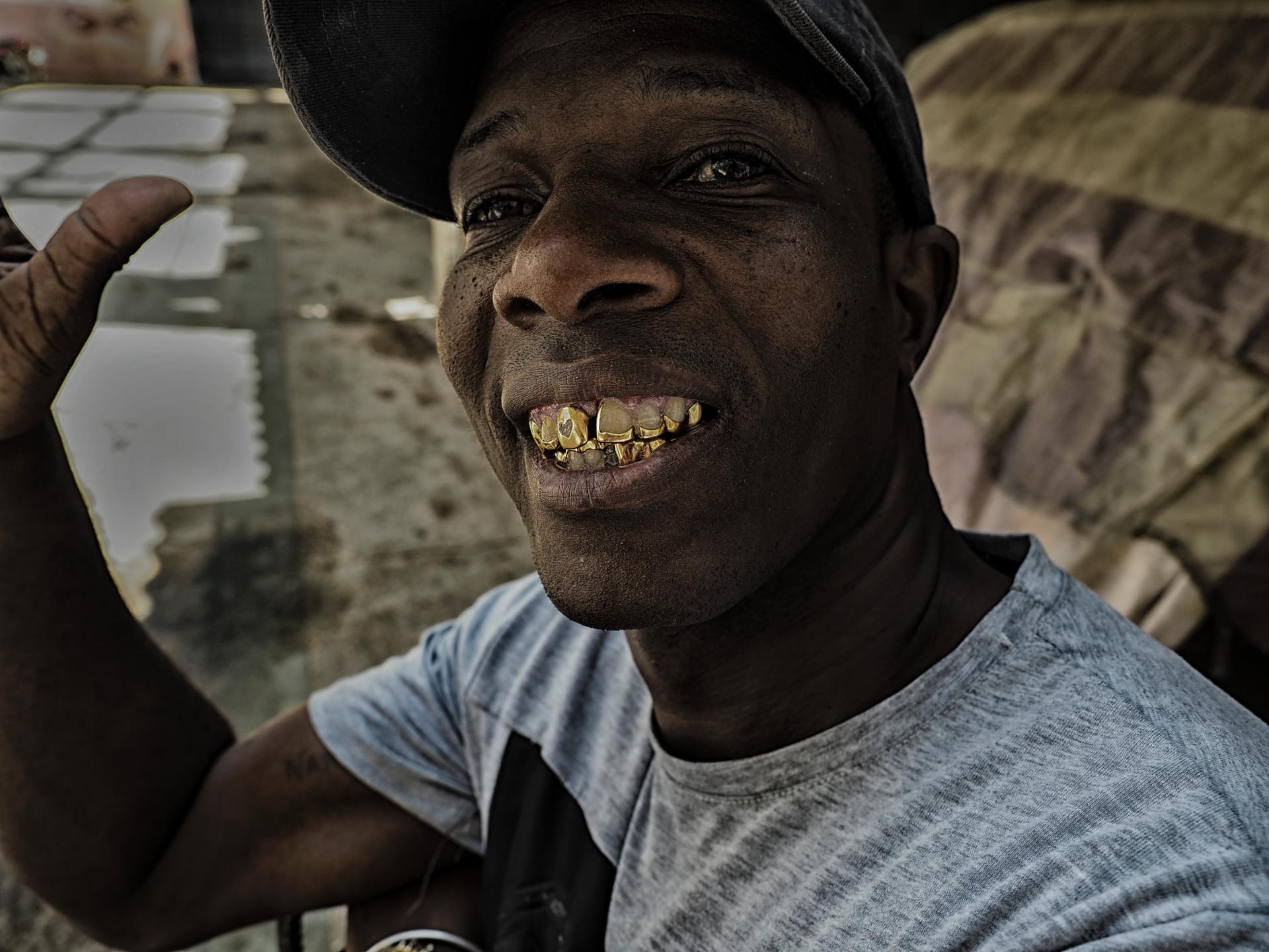 de l'or en bouche