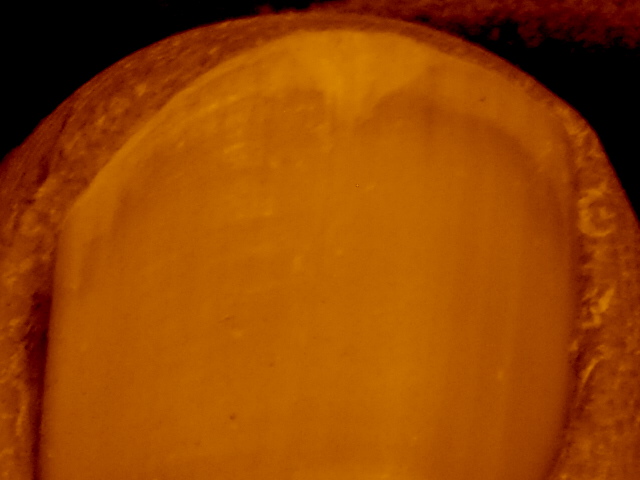 Doigt de pied ou de main